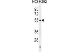 Western Blotting (WB) image for anti-Actin-Like 7A (ACTL7A) antibody (ABIN2995661) (Actin-Like 7A Antikörper)