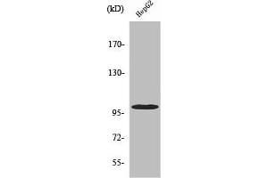 Western Blot analysis of HeLa cells using Vav2 Polyclonal Antibody (VAV2 Antikörper)