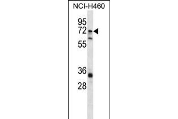 ST6GALNAC1 Antikörper  (N-Term)