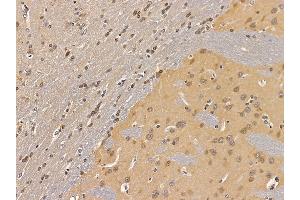 ABIN7094627 and ABIN7098677 at 1/100 staining rat brain tissue by IHC-P. (LOR Antikörper  (N-Term))