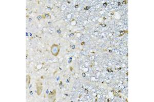 Immunohistochemistry of paraffin-embedded mouse spinal cord using DARS antibody (ABIN5973949) at dilution of 1/100 (40x lens). (DARS Antikörper)