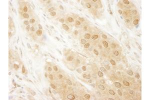 Immunohistochemistry (IHC) image for anti-Parkinson Protein 7 (PARK7) (C-Term) antibody (ABIN7448532)