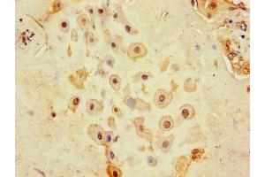 Immunohistochemistry of paraffin-embedded human placenta tissue using ABIN7147190 at dilution of 1:100 (CD9 Antikörper  (AA 112-195))