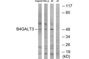 Western Blotting (WB) image for anti-UDP-Gal:betaGlcNAc beta 1,4- Galactosyltransferase, Polypeptide 3 (B4GALT3) (Internal Region) antibody (ABIN6300340) (B4GALT3 Antikörper  (Internal Region))