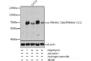 PRKAA1 Antikörper  (pThr172, pThr183)