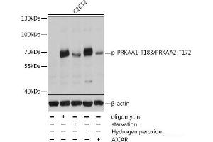 Western blot analysis of extracts of C2C12 cells using Phospho-PRKAA1(T183)/PRKAA2(T172) Polyclonal Antibody at dilution of 1:2000. (PRKAA1 Antikörper  (pThr172, pThr183))