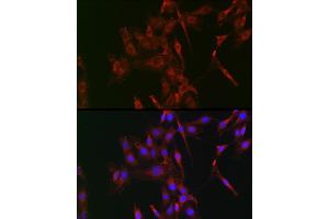 Immunofluorescence analysis of C6 cells using LOX Rabbit pAb (ABIN6133805, ABIN6143288, ABIN6143289 and ABIN6223629) at dilution of 1:100 (40x lens). (LOX Antikörper)