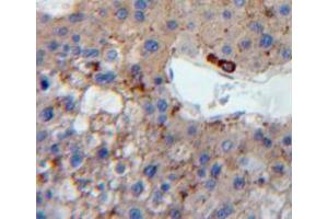 Used in DAB staining on fromalin fixed paraffin-embedded liver tissue (LDLR Antikörper  (AA 263-509))