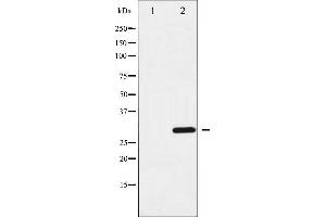 Western blot analysis of Cyclin D3 expression in Forskolin treated COS7 whole cell lysates,The lane on the left is treated with the antigen-specific peptide.