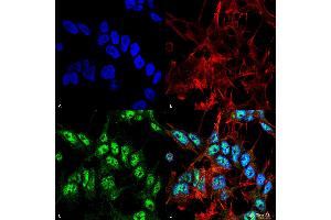 Immunocytochemistry/Immunofluorescence analysis using Rabbit Anti-Beclin 1 Polyclonal Antibody . (Beclin 1 Antikörper  (FITC))