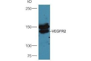 Mouse lung lysates probed with Anti-VEGFR2 Polyclonal Antibody  at 1:5000 90min in 37˚C. (VEGFR2/CD309 Antikörper  (AA 101-200))