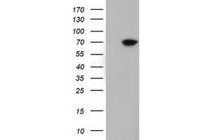 Image no. 5 for anti-EPM2A (Laforin) Interacting Protein 1 (EPM2AIP1) antibody (ABIN1498047) (EPM2AIP1 Antikörper)