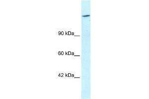 WB Suggested Anti-ARID4A Antibody Titration:  1. (ARID4A Antikörper  (C-Term))