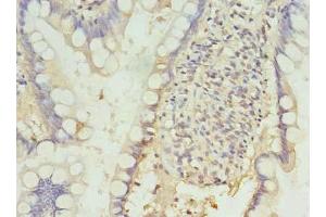 Immunohistochemistry of paraffin-embedded human small intestine tissue using ABIN7164683 at dilution of 1:100 (PD-1 Antikörper  (AA 21-170))
