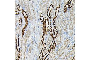 Immunohistochemistry of paraffin-embedded mouse kidney using  Rabbit pAb (ABIN3016811, ABIN3016812, ABIN3016813, ABIN1678723 and ABIN6219847) at dilution of 1:50 (40x lens). (AQP3 Antikörper  (AA 178-292))