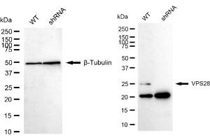 Western blotting analysis using VPS28 antibody (ABIN7800926).