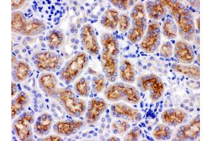Immunohistochemistry (IHC) image for anti-Cytochrome P450, Family 24, Subfamily A, Polypeptide 1 (CYP24A1) (AA 153-514) antibody (ABIN3042784)