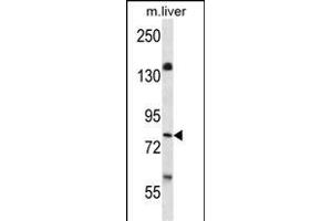 KI Antibody  (ABIN652432 and ABIN2842239) western blot analysis in mouse liver tissue lysates (35 μg/lane). (BRSK1 Antikörper  (C-Term))