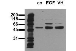 Western Blotting (WB) image for anti-SHC (Src Homology 2 Domain Containing) Transforming Protein 1 (SHC1) (pTyr317) antibody (ABIN126889) (SHC1 Antikörper  (pTyr317))