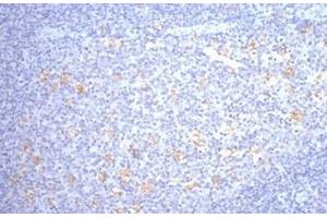 Immunohistochemistry of paraffin-embedded Human tonsil tissue using CD68 Monoclonal Antibody at dilution of 1:200. (CD68 Antikörper)
