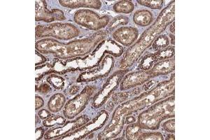 Immunohistochemical staining of human kidney with SPANXN4 polyclonal antibody  shows strong cytoplasmic positivity in cells of tubules at 1:10-1:20 dilution.