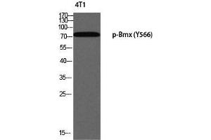 Western Blot (WB) analysis of 4T1 using p-Bmx (Y566) antibody. (BMX Antikörper  (pTyr566))