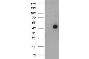 Image no. 1 for anti-LIM Homeobox 1 (LHX1) (AA 100-362) antibody (ABIN1490807) (LHX1 Antikörper  (AA 100-362))