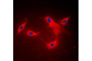 Immunofluorescent analysis of LYPLA1 staining in MDAMB453 cells.