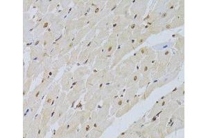 Immunohistochemistry of paraffin-embedded Rat heart using SNRPA Polyclonal Antibody at dilution of 1:100 (40x lens). (SNRPA1 Antikörper)