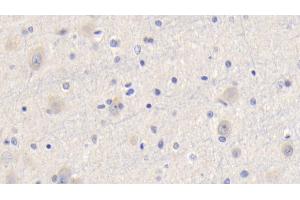 Detection of CYPA in Human Cerebrum Tissue using Polyclonal Antibody to Cyclophilin A (CYPA) (PPIA Antikörper  (AA 2-165))