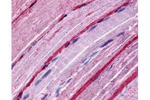 Immunohistochemical (Formalin/PFA-fixed paraffin-embedded sections) staining in human myocytes with GRK5 polyclonal antibody . (GRK5 Antikörper)
