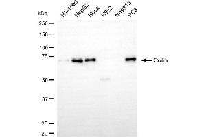 Western blotting analysis using coilin antibody (ABIN7798119). (Rekombinanter Coilin Antikörper)