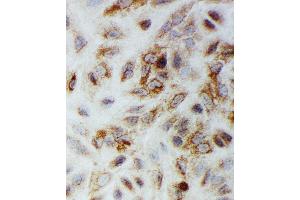 Anti-Smad1 antibody, ICC ICC: A549 Cell (SMAD1 Antikörper  (C-Term))