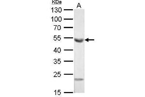 WB Image ALDH1A1 antibody [C3], C-term detects ALDH1A1 protein by Western blot analysis. (ALDH1A1 Antikörper  (C-Term))