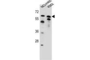 Western blot analysis in NCI-H460, K562 cell line lysates (35ug/lane) using PLAG1  Antibody (N-term). (PLAG1 Antikörper  (N-Term))