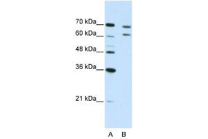 CPSF3 antibody used at 5 ug/ml to detect target protein. (CPSF3 Antikörper  (N-Term))