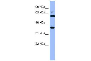 CYP2B6 antibody used at 1 ug/ml to detect target protein. (CYP2B6 Antikörper  (Middle Region))