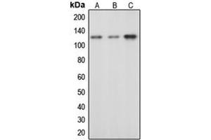 Western blot analysis of c-CBL (pY674) expression in HeLa EGF-treated (A), mouse liver (B), rat liver (C) whole cell lysates. (CBL Antikörper  (pTyr674))