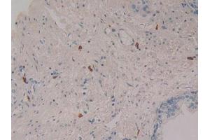IHC-P analysis of Human Prostate Gland Tissue, with DAB staining. (LEAP2 Antikörper  (AA 23-76))