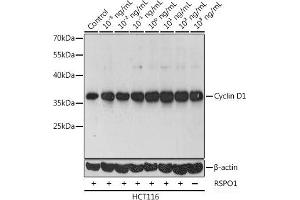 Western blot analysis of extracts of HCT116 cells using Cyclin D1 Polyclonal Antibody at dilution of 1:1000. (Cyclin D1 Antikörper)