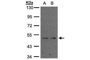 WB Image Sample(30 ug whole cell lysate) A:MOLT4 , B:Raji , 10% SDS PAGE antibody diluted at 1:2000 (IFRD1 Antikörper)