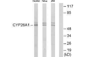 Western blot analysis of extracts from HepG2 cells, HeLa cells and 293 cells, using Cytochrome P450 26A1 antibody. (CYP26A1 Antikörper)