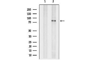 anti-Nicastrin (NCSTN) (C-Term) antibody