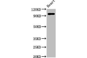 Western Blot Positive WB detected in: Rat heart tissue All lanes: GRM2 antibody at 5 μg/mL Secondary Goat polyclonal to rabbit IgG at 1/50000 dilution Predicted band size: 96 kDa Observed band size: 96 kDa (GRM2 Antikörper  (AA 93-221))