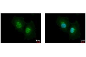 ICC/IF Image ASL antibody detects ASL protein at cytoplasm and nucleus by immunofluorescent analysis. (ASL Antikörper)