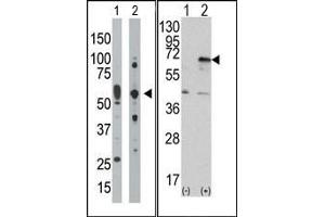 Image no. 1 for anti-Eukaryotic Translation Initiation Factor 2-alpha Kinase 2 (EIF2AK2) (C-Term) antibody (ABIN360664) (EIF2AK2 Antikörper  (C-Term))