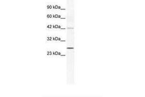Image no. 1 for anti-Gap Junction Protein, beta 4, 30.3kDa (GJB4) (AA 86-135) antibody (ABIN202138) (GJB4 Antikörper  (AA 86-135))