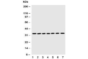 Western Blotting (WB) image for anti-Enoyl-CoA Delta Isomerase 1 (ECI1) (C-Term) antibody (ABIN3030698)