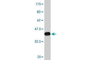 Western Blot detection against Immunogen (36. (NDRG2 Antikörper  (AA 1-96))
