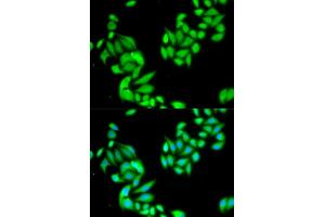 Immunofluorescence analysis of HeLa cells using IKBKB antibody. (IKBKB Antikörper)